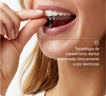 BANDAS DENTES BRANCOS