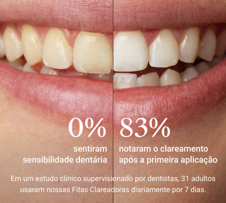 BANDAS DENTES BRANCOS